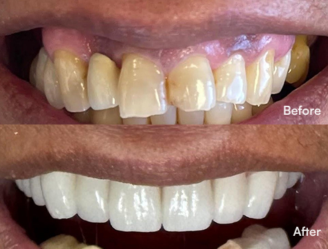 Before-After Image