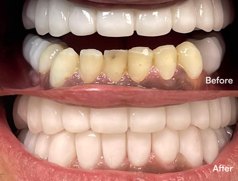 Before-After Image