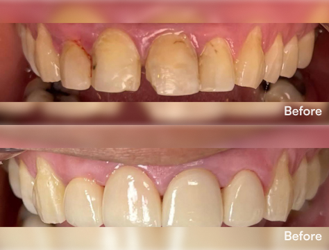 Before-After Image