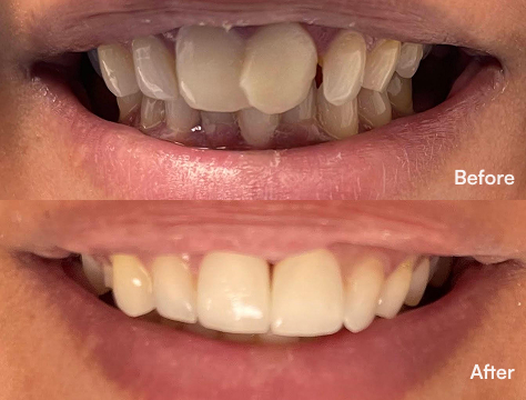 Before-After Image