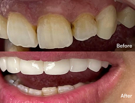 Before-After Image