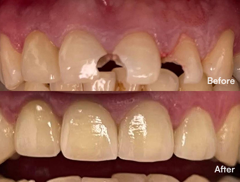 Before-After Image