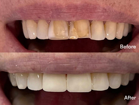 Before-After Image