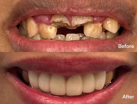 Before-After Image
